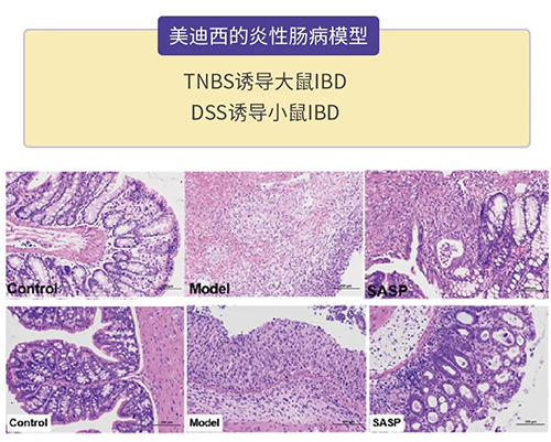CA88的炎症性肠病模子