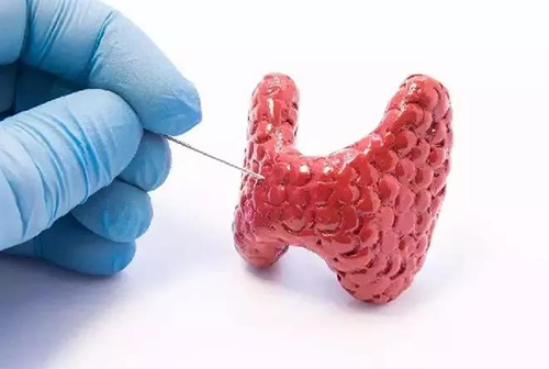 甲状腺疾病，，，，，，，包括甲状腺功效减退和甲状腺功效亢进，，，，，，，自古以来就是重复被医学研究职员研究的疾病