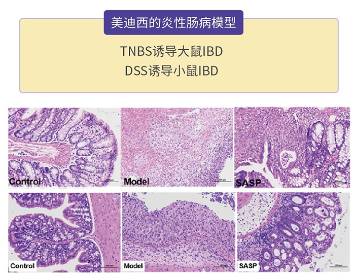 CA88的炎性肠病模子.png CA88的炎性肠病模子.png
