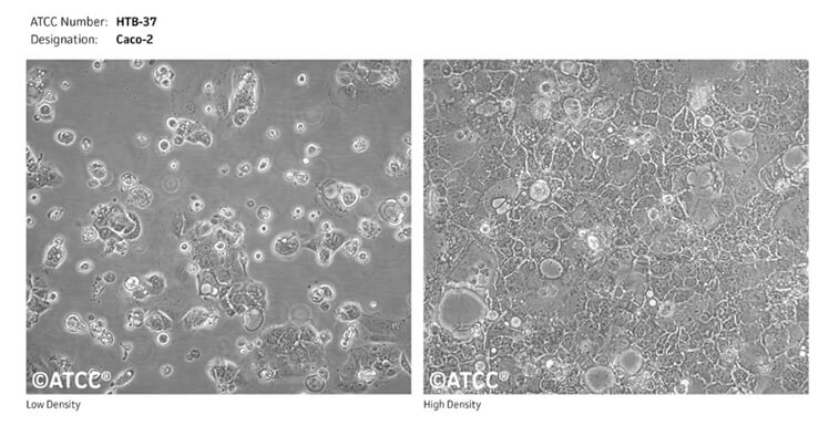 Caco-2细胞(泉源--ATCC).jpg Caco-2细胞(泉源--ATCC).jpg
